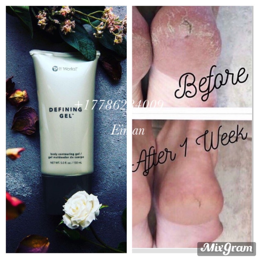 Defining gel - Picture 2 of 2